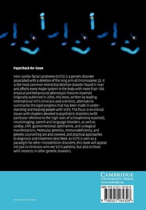 Velo-Cardio-Facial Syndrome achterzijde