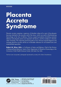 Placenta Accreta Syndrome achterzijde