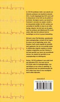 150 ECG-problemen achterzijde