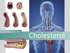 Cholesterol achterzijde