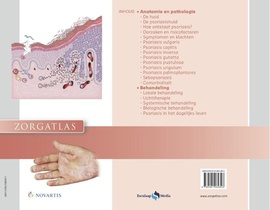 Psoriasis achterzijde