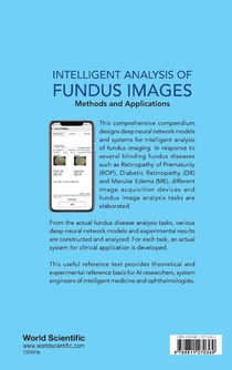 Intelligent Analysis Of Fundus Images: Methods And Applications achterzijde