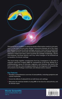 Advances In Mri Of The Knee For Osteoarthritis achterzijde