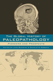 The Global History of Paleopathology