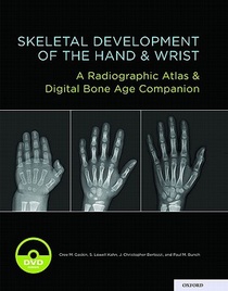 Skeletal Development of the Hand and Wrist