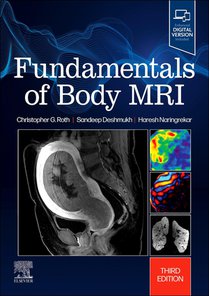 Fundamentals of Body MRI voorzijde