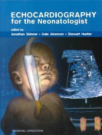 Echocardiography for the Neonatologist