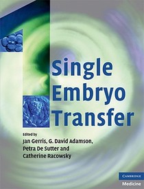 Single Embryo Transfer voorzijde