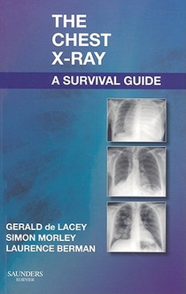 The Chest X-Ray: A Survival Guide