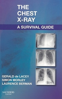 The Chest X-Ray: A Survival Guide voorzijde