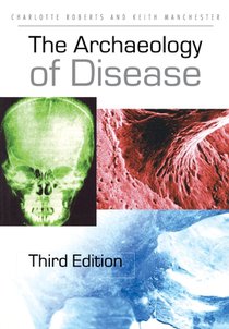 The Archaeology of Disease voorzijde