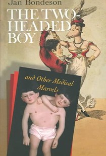 The Two-headed Boy, and Other Medical Marvels