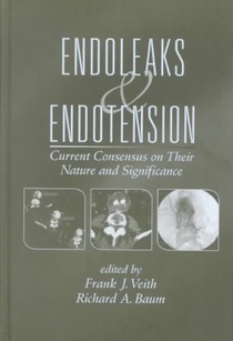 Endoleaks and Endotension voorzijde