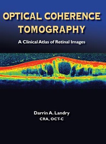 Optical Coherence Tomography