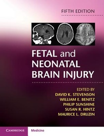 Fetal and Neonatal Brain Injury voorzijde