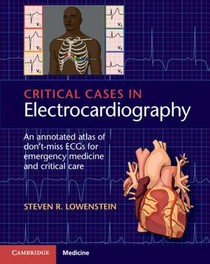 Critical Cases in Electrocardiography