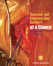 Vascular and Endovascular Surgery at a Glance voorzijde