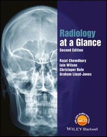 Radiology at a Glance voorzijde