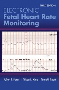 Electronic Fetal Heart Rate Monitoring: the 5-Tier System