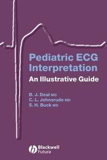 Pediatric ECG Interpretation