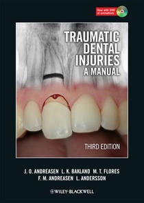 Traumatic Dental Injuries