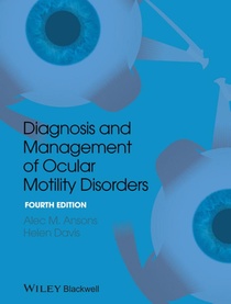 Diagnosis and Management of Ocular Motility Disorders