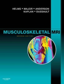 Musculoskeletal MRI