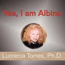 Yes, I am Albino