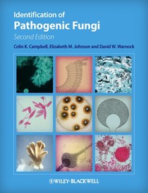 Identification of Pathogenic Fungi