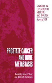 Prostate Cancer and Bone Metastasis