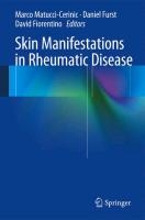 Skin Manifestations in Rheumatic Disease