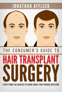 The Consumer's Guide to Hair Transplant Surgery: Everything You Wanted to Know About Hair Transplantation