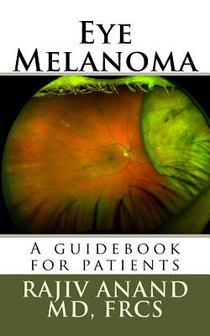 Eye Melanoma: A manual for patients