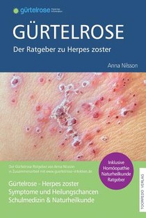 Gürtelrose - Der große Ratgeber zu Herpes zoster: Schulmedizin + Naturheilkunde