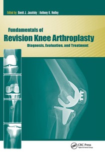 Fundamentals of Revision Knee Arthroplasty