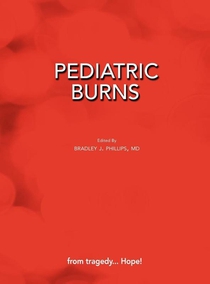 Pediatric Burns