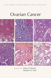 Ovarian Cancer