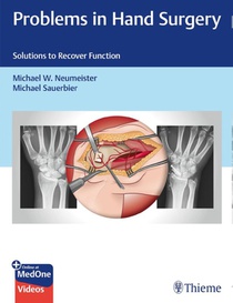 Problems in Hand Surgery
