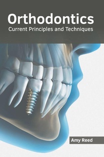 Orthodontics: Current Principles and Techniques