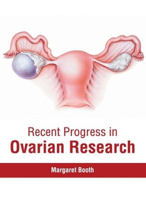 Recent Progress in Ovarian Research