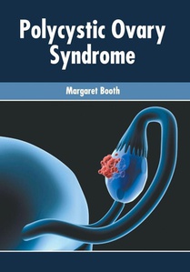 Polycystic Ovary Syndrome