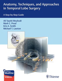 Anatomy, Techniques, and Approaches in Temporal Lobe Surgery