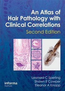 An Atlas of Hair Pathology with Clinical Correlations voorzijde