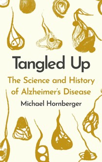 Tangled Up: The History and Science of Alzheimer's Disease