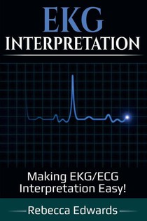 EKG Interpretation