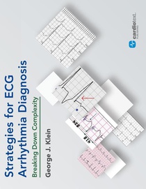 Strategies for ECG Arrhythmia Diagnosis