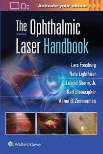 The Ophthalmic Laser Handbook