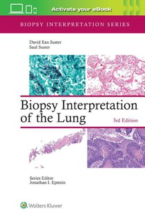 Biopsy Interpretation of the Lung