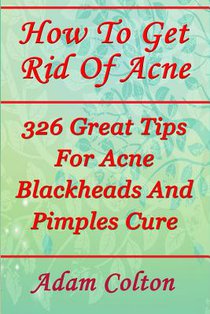 How To Get Rid Of Acne: 326 Great Tips For Acne Blackheads And Pimples Cure