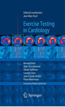 Exercise testing in cardiology